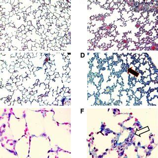 Lung Histology And Collagen Deposition Histological Analysis Was