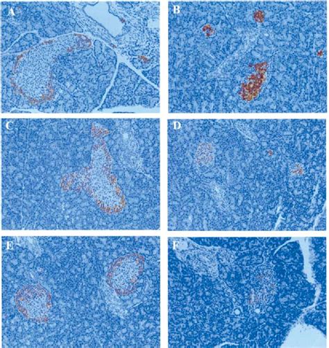 Figure From Glucocorticoids Suppress Beta Cell Development And Induce