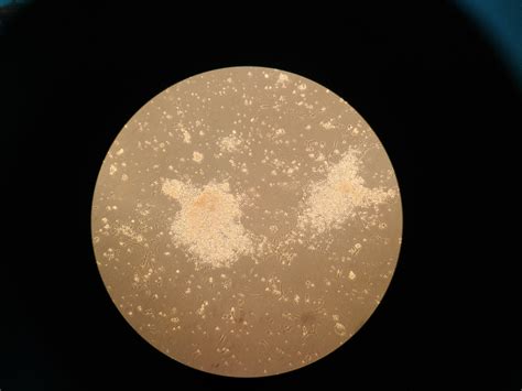 1506 questions with answers in PLATING | Science topic