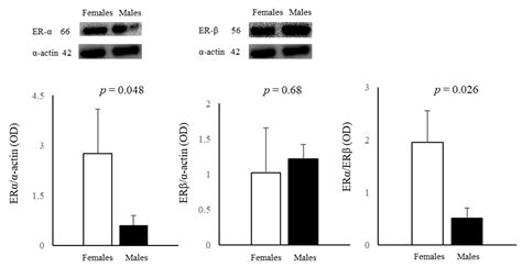 Stratification Of Amniotic Fluid Cells And Amniotic Fluid By Sex Opens