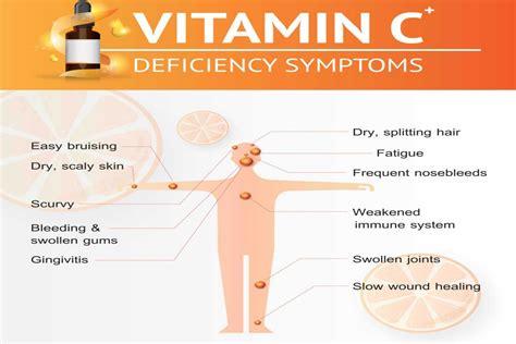 Vitamin C For Breastfeeding Mothers Everything You Need To Know