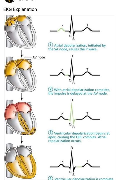 Ecg interpretation – Artofit