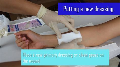 Principles Of Wound Dressing Classification With Return Demonstration Youtube