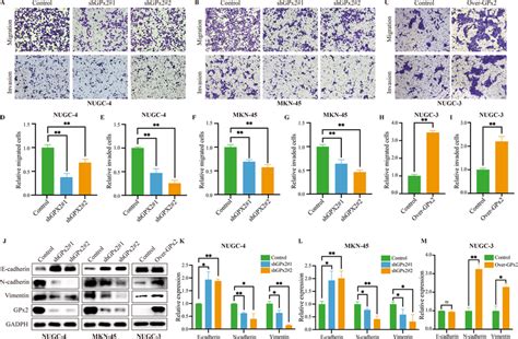 GPx2 Expression Promoted GC Invasion Migration And EMT In Vitro A B