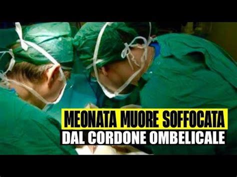 Neonata Muore Soffocata Dal Cordone Ombelicale Tragedia All Ospedale