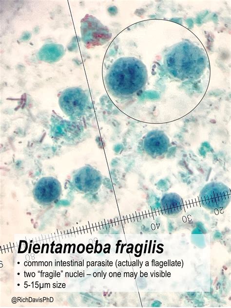 Dientamoeba Fragilis Trichrome