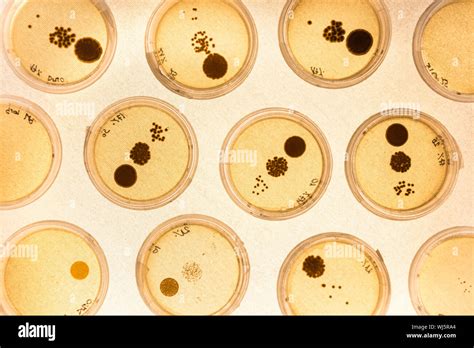 Cultivo De Bacterias Hisopo Fotograf As E Im Genes De Alta Resoluci N