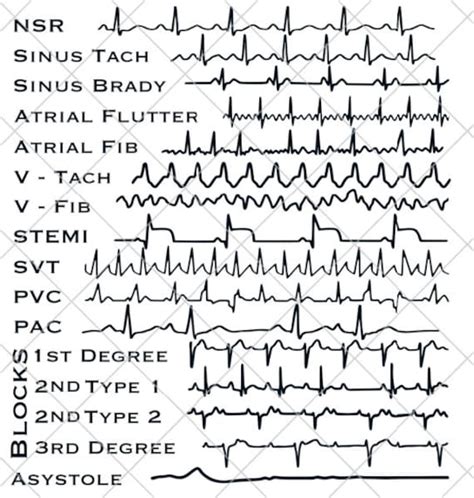 EKG Strips SVG Cardiac Monitor Nurse Technician Doctor Gift