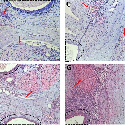 Expression Of PGP9 5 A Substance P B NK1R Positive Blood Vessels