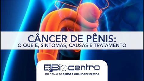 Câncer de pênis o que é sintomas causas e tratamento YouTube