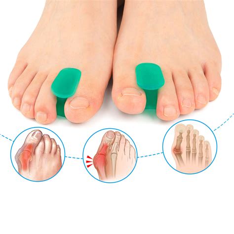 Sumifun Pairs Toe Spacer Silicone Toe Separator Bunion Straightener