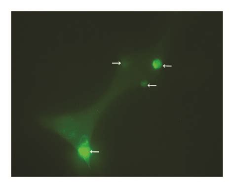 Phagocytosis Of Monocytes Induced Macrophage As Demonstrated By Cfse