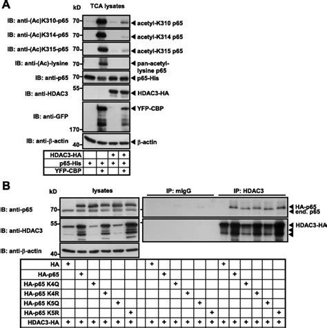 Hdac Binds To And Deacetylates P At Lysines K K And K A