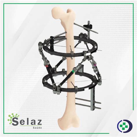 Fixadores Externos Quartz Hexapod System Acertta Hospitalar