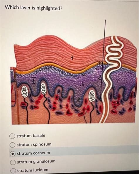 Solved Which layer is highlighted? stratum basale stratum | Chegg.com