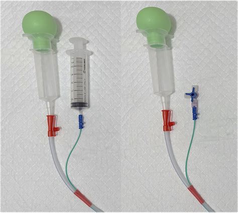 Improvised Dual Lumen Nasojejunal Feeding Tube With Gastric