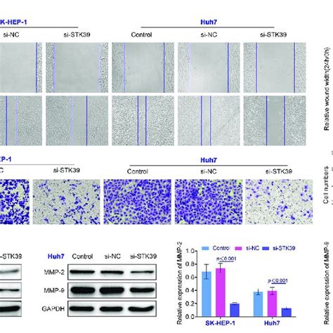 Knockdown Of Stk Inhibited The Invasiveness Of Hcc Cells A The