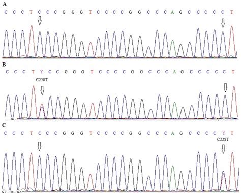 Figure 1 From Tert Promoter Mutations And Polymorphisms As Prognostic