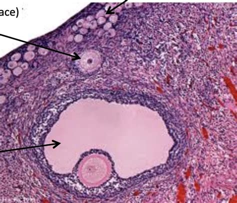 ovary histology Diagram | Quizlet