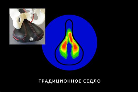 Эргономичное велоседло без носика Ergosmart - Ergosmart.ru