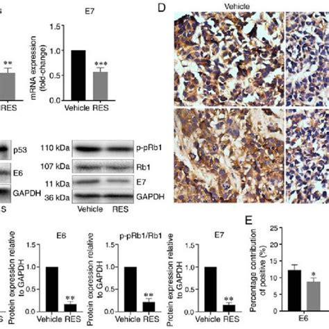 Resveratrol Inhibits Hpv E E Expression In Cancer Tissues Of Hela