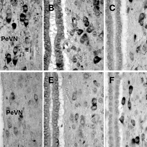 Representative Microphotographs Of Som Ir Cells In The Pevn Of Mini And