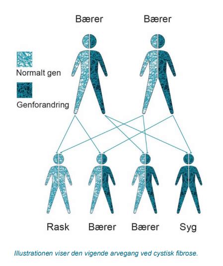Hvad Er Cystisk Fibrose
