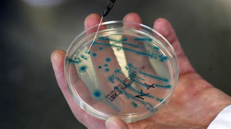 ‘Devastating’ implications of drug-resistant superbugs now a reality – WHO — RT World News