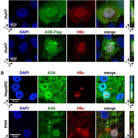 Co Localization Of A3a And A3b With Hbv Core Protein Hbc A Huh7