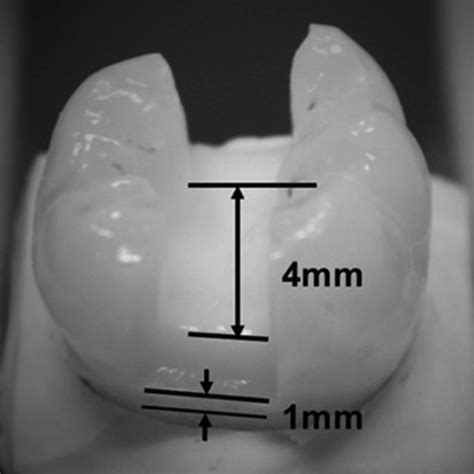 PDF Shrinkage Stress Of High And Low Viscosity Bulk Fill Composites