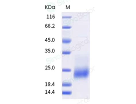 Sino Biological Human TIGIT Protein ECD His AVI Tag Biotinylated