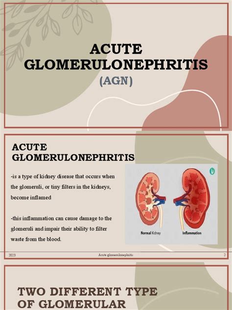 Acute Glomerulonephritis Pdf