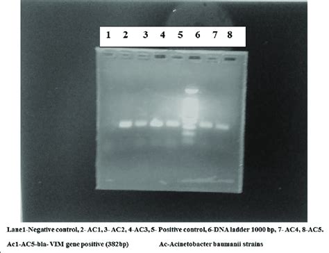 Gel Showing Pcr Products Download Scientific Diagram