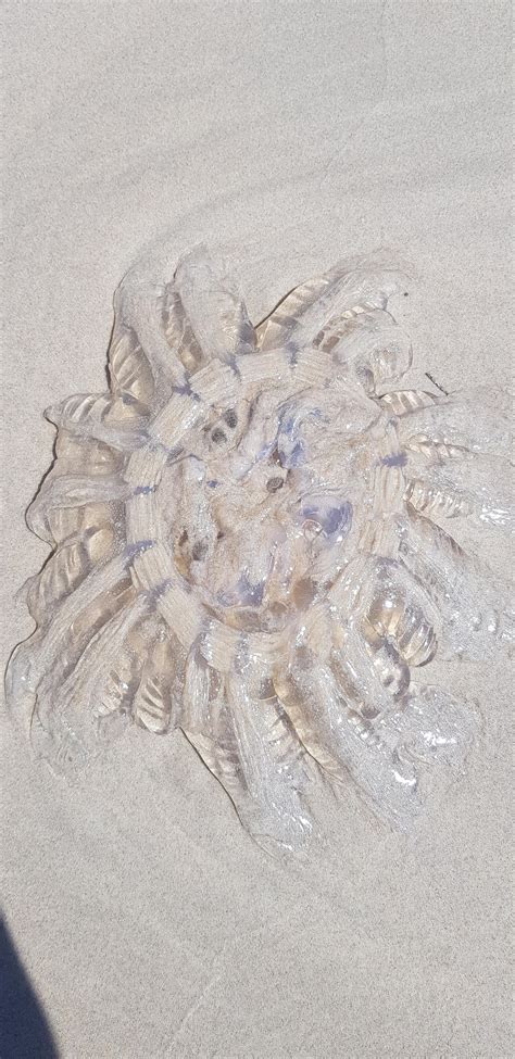 Jellyfish sting at Altona beach in Melbourne Australia. I believe it ...