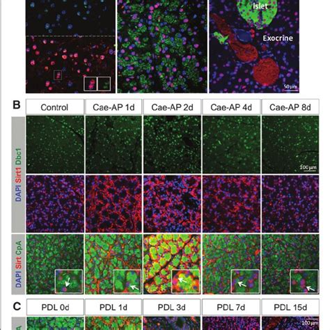 Sirt Expression And Function In Pdac A Western Blotting For Sirt B