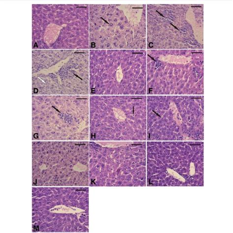 Photomicrographs Of Liver Sections Of The Control Group A