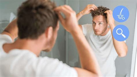 6 Accurate Signs Of Balding How Can I Know If Im Going Bald