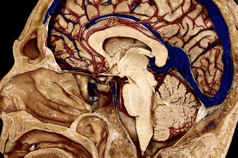 Mid-Sagittal Perspective of Right Hemisphere, Brainstem, and Cerebellum ...