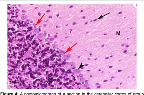 Purkinje Cells Histology