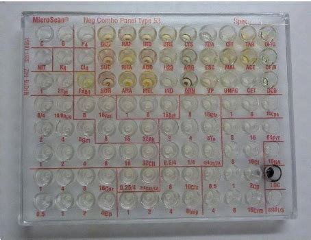 Memoire Online Antibiorésistance des entérobacteries productrices de