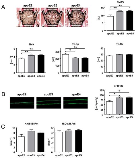 Human Apolipoprotein E Isoforms Differentially Affect Bone Mass And