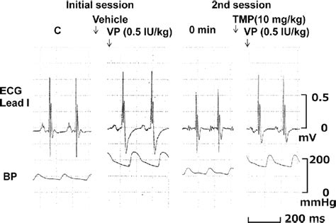 Typical Tracings Showing The Effects Of Tetramethylpyrazine Tmp On