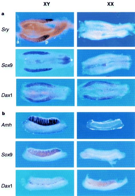 Expression Of Genital Ridge Markerswhole Mount In Situ Hybridization