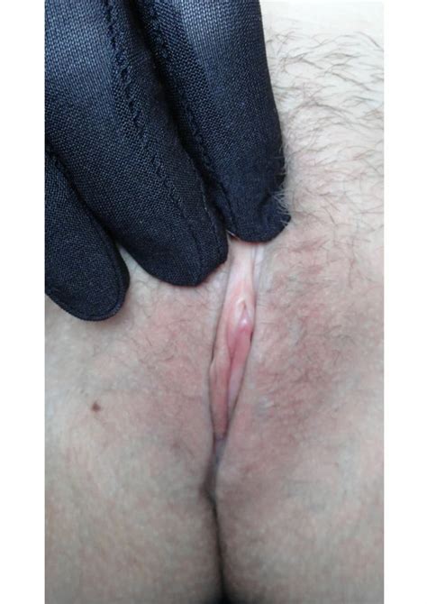 Exposing My Clit Nude Pics XHamster