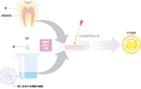 リプログラミングの種類