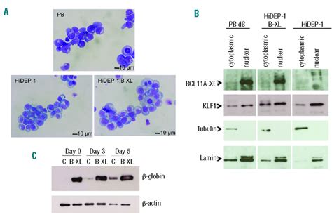 Induction of adult levels of β globin in human erythroid cells that