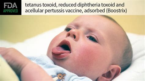 Fda Oks Tdap Vaccine For Whooping Cough Protection Before Birth Medpage Today