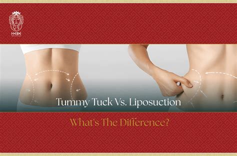 Tummy Tuck Vs Liposuction What S The Difference