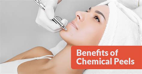 Top 4 Benefits of Chemical Peels [2019] | Fairview Laser Clinic Inc.