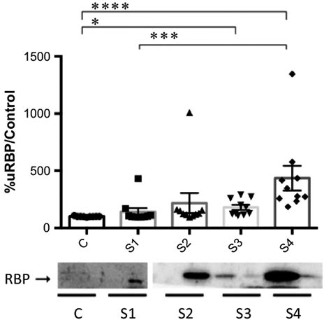 Densitometric Analysis Of Urinary Retinol Binding Protein Rbp By